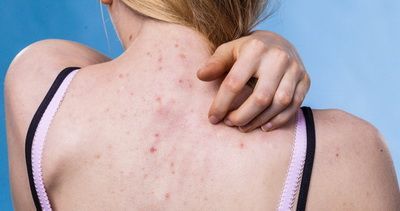 Сыпь на коже: причины и заболевания