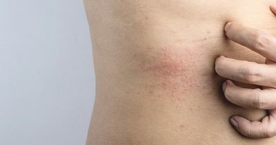 Как правильно ухаживать за кожей с атопическим дерматитом: что можно и нельзя делать