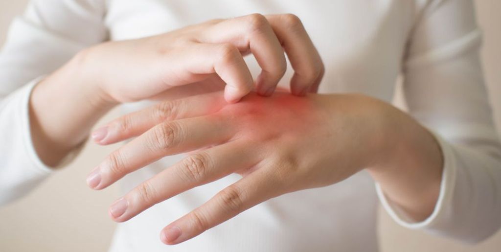 Эффективное лечение экземы на пальцах рук